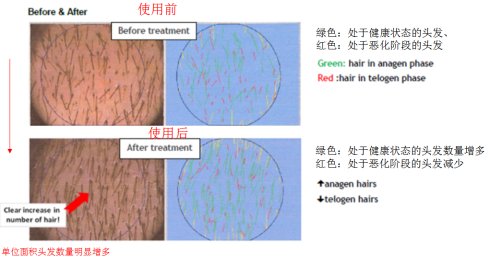 风靡欧洲的防脱发神器：BottegadiLungaVita(葆缇嘉)让脱发者不再脱发